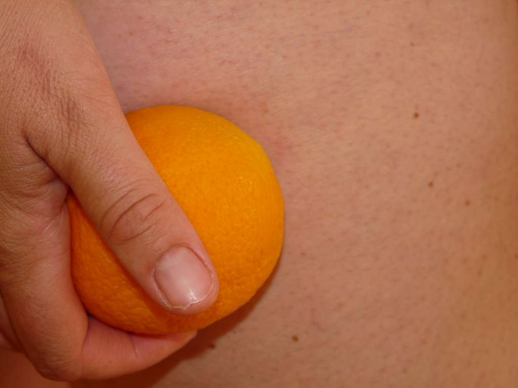 8 remèdes naturels pour lutter contre la peau d'orange